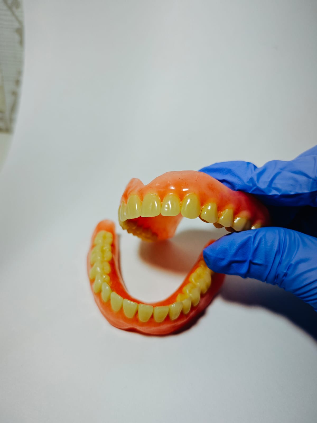 Gigi palsu akrilik Surabaya oleh Rofiqi Dental
