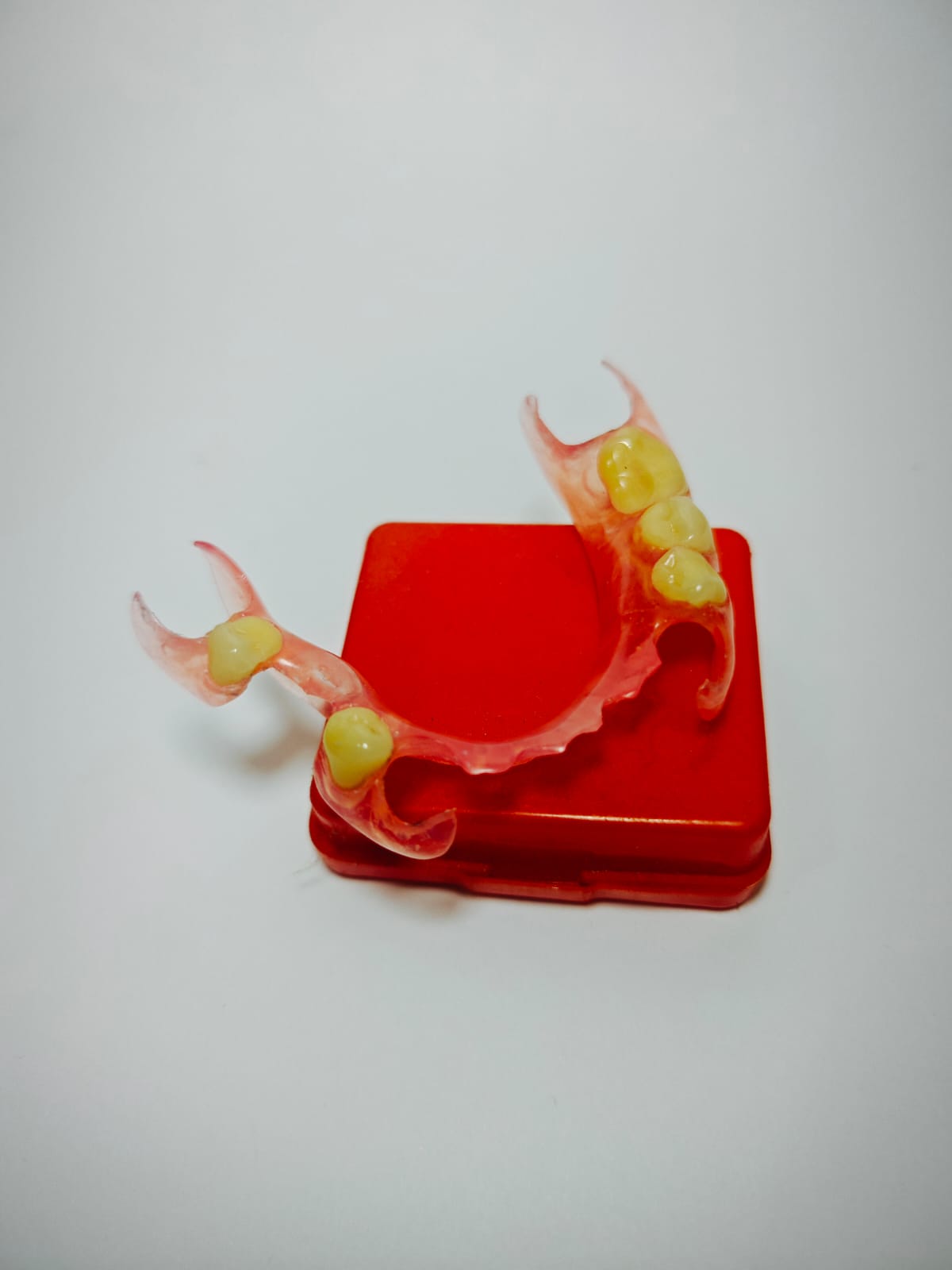 Contoh hasil gigi palsu Valplast yang telah selesai dibuat Rofiqi Dental