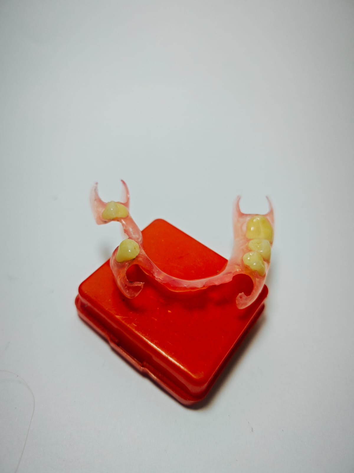 Contoh hasil gigi palsu Valplast Rofiqi Dental 2