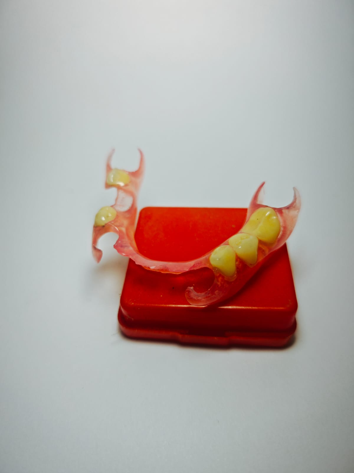 Contoh hasil gigi palsu Valplast Rofiqi Dental 4